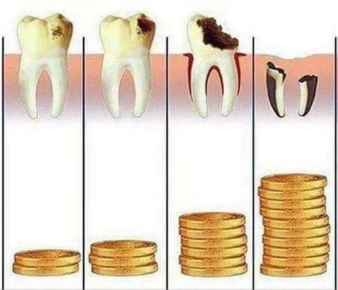 Precios de Tratamientos Dentales